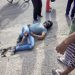 Jovem que se envolveu em acidente na ladeira do Itapoã, veio a óbito na mesa de cirurgia.