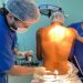 Primeiro mutirão de cirurgias ortopédicas de 2024 é finalizado com sucesso no Hospital Regional