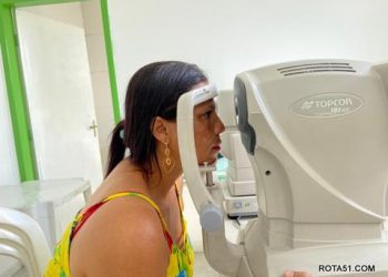 Mutirão oftalmológico beneficia 80 pacientes das UBSs do Sapucaeira e Santa Lúcia