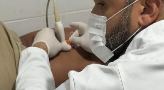 Saúde em ação: Prefeitura de Eunápolis realiza segunda etapa da escleroterapia