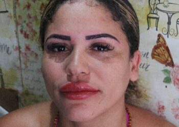 SALÃO DE ESTÉTICA FACIAL, ALTAMENTE PROFISSIONAL E COM UM DOS MAIS ANTIGOS ESTETICISTA DE EUNÁPOLIS.